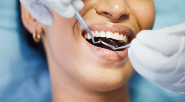 Best Emergency Tooth Extraction in Dunn, NC