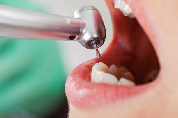 Best Emergency Treatment for Toothache in Dunn, NC